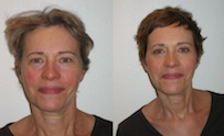 Relooking de Simone